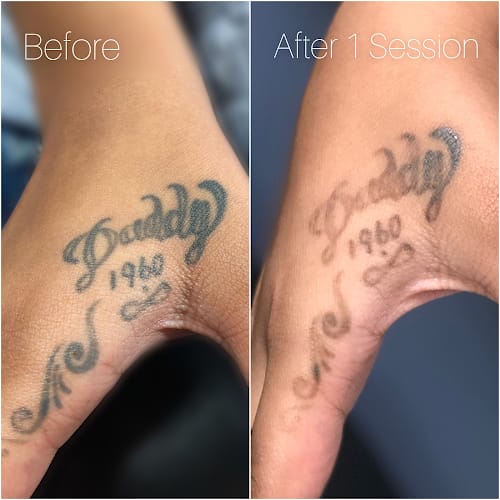 Bad Habits Tattoos & Laser Tattoo Removal